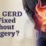 Can GERD be fixed without surgery? with man holding stomach in pain